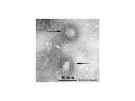 2019-nCoV-betacoronavirüs-elektron-mikroskobu-görüntüsü