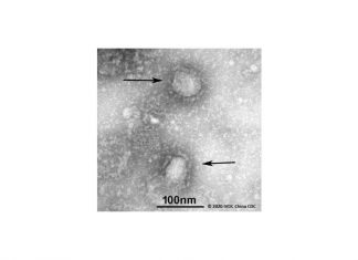 2019-nCoV-betacoronavirüs-elektron-mikroskobu-görüntüsü