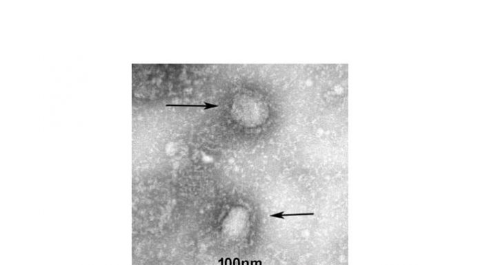 2019-nCoV-betacoronavirüs-elektron-mikroskobu-görüntüsü